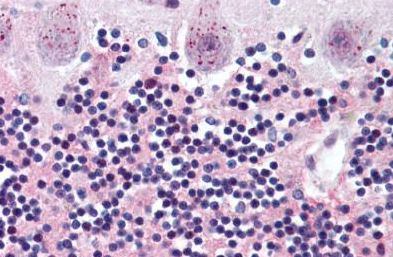 Immunohistochemistry (Formalin/PFA-fixed paraffin-embedded sections) - Anti-Wnt2/IRP antibody (AB150608), expandable thumbnail