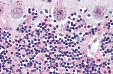 Immunohistochemistry (Formalin/PFA-fixed paraffin-embedded sections) - Anti-Wnt2/IRP antibody (AB150608)