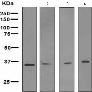 Western blot - Anti-Wnt2/IRP antibody [EPR3101(2)] (AB109222)