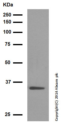 Western blot - Anti-Wnt2/IRP antibody [EPR3101(2)] (AB109222), expandable thumbnail