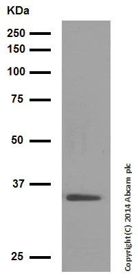 Western blot - Anti-Wnt2/IRP antibody [EPR3101(2)] (AB109222)