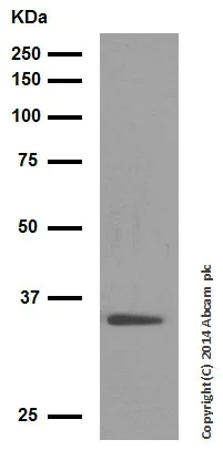 Western blot - Anti-Wnt2/IRP antibody [EPR3101(2)] - BSA and Azide free (AB232036)