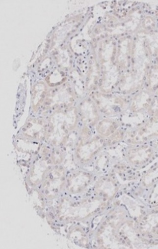 Immunohistochemistry (Formalin/PFA-fixed paraffin-embedded sections) - Anti-Wnt2b antibody (AB203225), expandable thumbnail