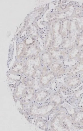 Immunohistochemistry (Formalin/PFA-fixed paraffin-embedded sections) - Anti-Wnt2b antibody (AB203225)