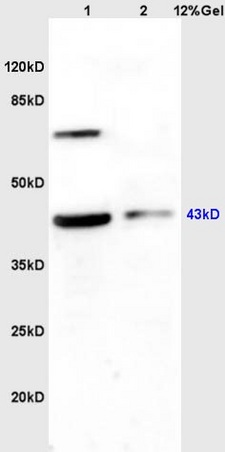 Western blot - Anti-Wnt2b antibody (AB203225), expandable thumbnail