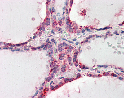 Immunohistochemistry (Formalin/PFA-fixed paraffin-embedded sections) - Anti-Wnt3 antibody (AB116222), expandable thumbnail