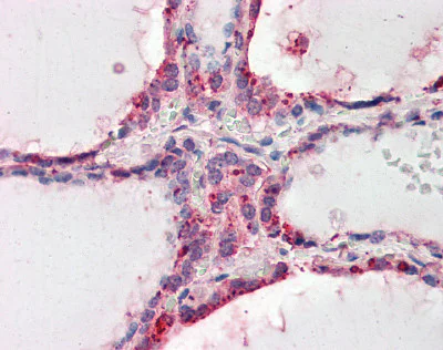 Immunohistochemistry (Formalin/PFA-fixed paraffin-embedded sections) - Anti-Wnt3 antibody (AB116222)