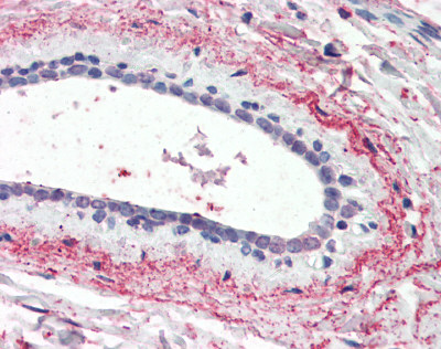 Immunohistochemistry (Formalin/PFA-fixed paraffin-embedded sections) - Anti-Wnt3 antibody (AB116222), expandable thumbnail