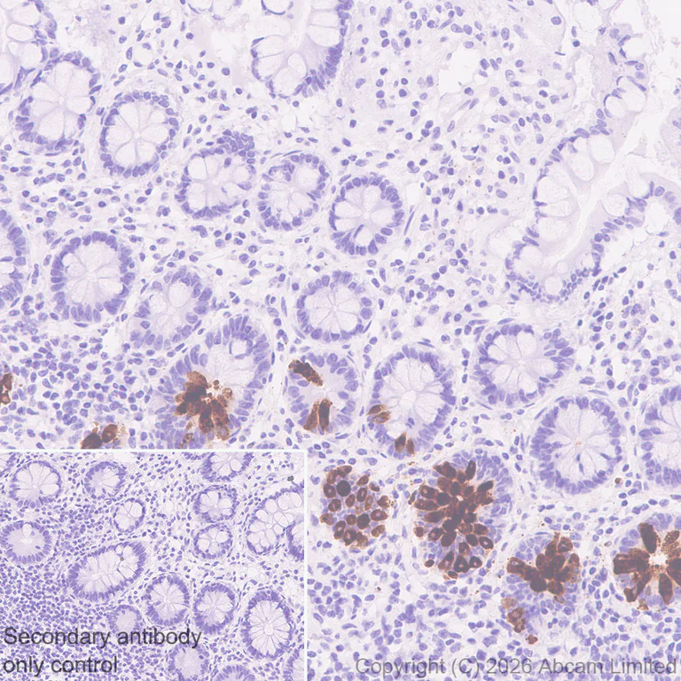 Immunohistochemistry (Formalin/PFA-fixed paraffin-embedded sections) - Anti-Wnt3 antibody [EPR29462-511] (AB325601)