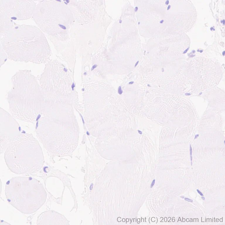 Immunohistochemistry (Formalin/PFA-fixed paraffin-embedded sections) - Anti-Wnt3 antibody [EPR29462-511] (AB325601)