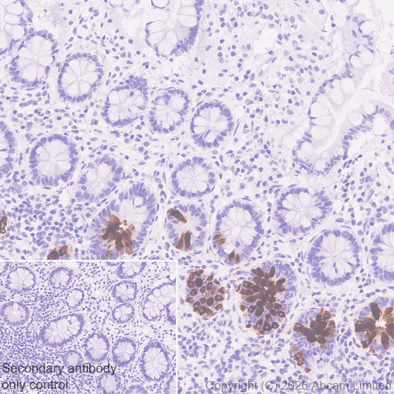 Immunohistochemistry (Formalin/PFA-fixed paraffin-embedded sections) - Anti-Wnt3 antibody [EPR29462-511] - BSA and Azide free (AB328049)