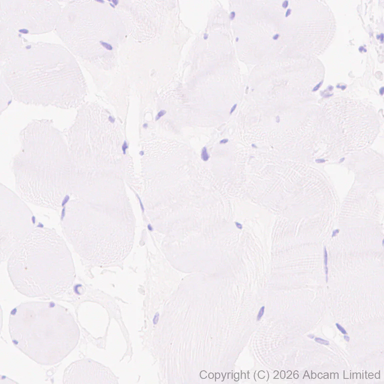Immunohistochemistry (Formalin/PFA-fixed paraffin-embedded sections) - Anti-Wnt3 antibody [EPR29462-511] - BSA and Azide free (AB328049)