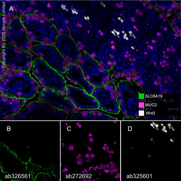 Multiplex immunohistochemistry - Anti-Wnt3 antibody [EPR29462-511] - BSA and Azide free (AB328049)