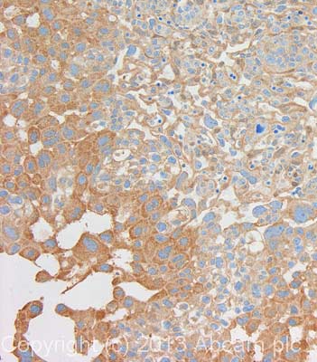 Immunohistochemistry (Formalin/PFA-fixed paraffin-embedded sections) - Anti-Wnt3a antibody (AB19925)