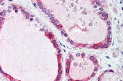 Immunohistochemistry (Formalin/PFA-fixed paraffin-embedded sections) - Anti-Wnt4 antibody (AB150596), expandable thumbnail