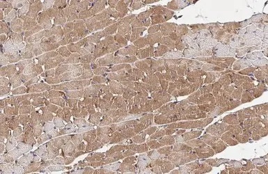 Immunohistochemistry (Formalin/PFA-fixed paraffin-embedded sections) - Anti-Wnt5a antibody (AB227229)