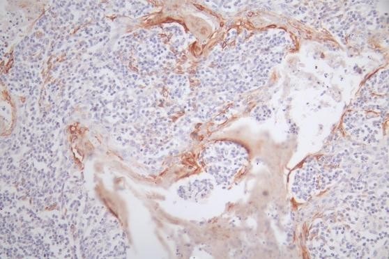 Immunohistochemistry (Formalin/PFA-fixed paraffin-embedded sections) - Anti-Wnt5a antibody (AB235966), expandable thumbnail