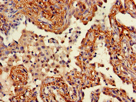 Immunohistochemistry (Formalin/PFA-fixed paraffin-embedded sections) - Anti-Wnt5a antibody (AB235966), expandable thumbnail