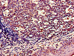 Immunohistochemistry (Formalin/PFA-fixed paraffin-embedded sections) - Anti-Wnt5a antibody (AB235966), expandable thumbnail