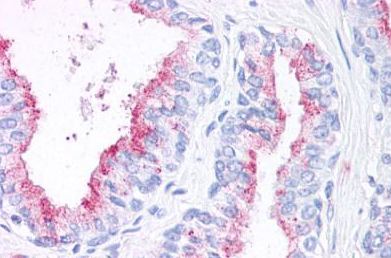Immunohistochemistry (Formalin/PFA-fixed paraffin-embedded sections) - Anti-Wnt5b antibody (AB150602), expandable thumbnail