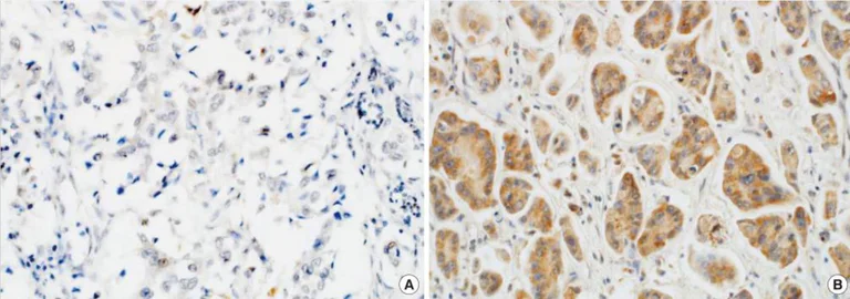 Immunohistochemistry (Formalin/PFA-fixed paraffin-embedded sections) - Anti-Wnt7a antibody (AB183653)