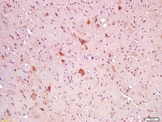 Immunohistochemistry (Formalin/PFA-fixed paraffin-embedded sections) - Anti-Wnt8a antibody (AB203589), expandable thumbnail