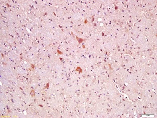 Immunohistochemistry (Formalin/PFA-fixed paraffin-embedded sections) - Anti-Wnt8a antibody (AB203589)