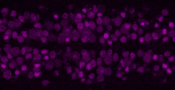 Immunohistochemistry - Anti-Worniu antibody [5A3AD2] (AB196362), expandable thumbnail