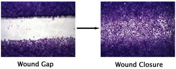 Functional Studies (Act) - Wound Healing Assay (AB242285)