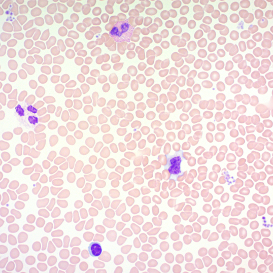 Staining - Wright-Giemsa Stain Kit (AB245888), expandable thumbnail