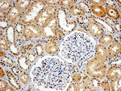 Immunohistochemistry (Formalin/PFA-fixed paraffin-embedded sections) - Anti-WRNIP1/WHIP antibody (AB18729)