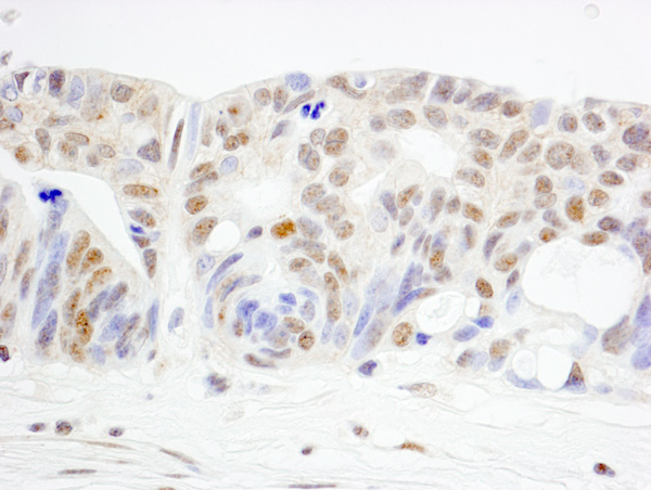Immunohistochemistry (Formalin/PFA-fixed paraffin-embedded sections) - Anti-WRNIP1/WHIP antibody (AB99316)