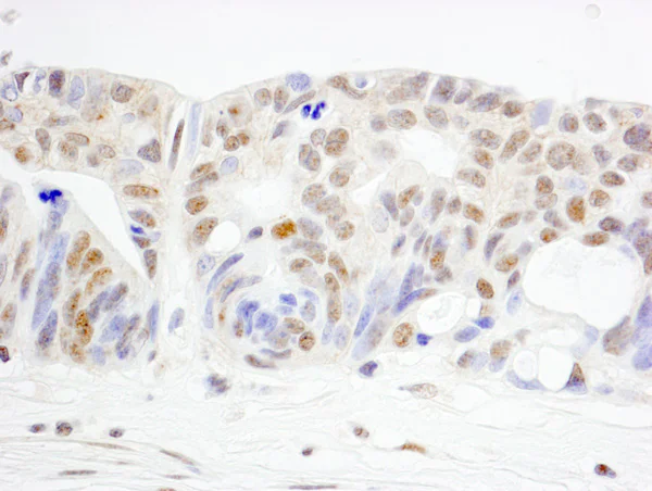 Immunohistochemistry (Formalin/PFA-fixed paraffin-embedded sections) - Anti-WRNIP1/WHIP antibody (AB99316)