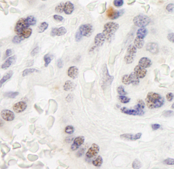 Immunohistochemistry (Formalin/PFA-fixed paraffin-embedded sections) - Anti-WSTF antibody (AB70263)