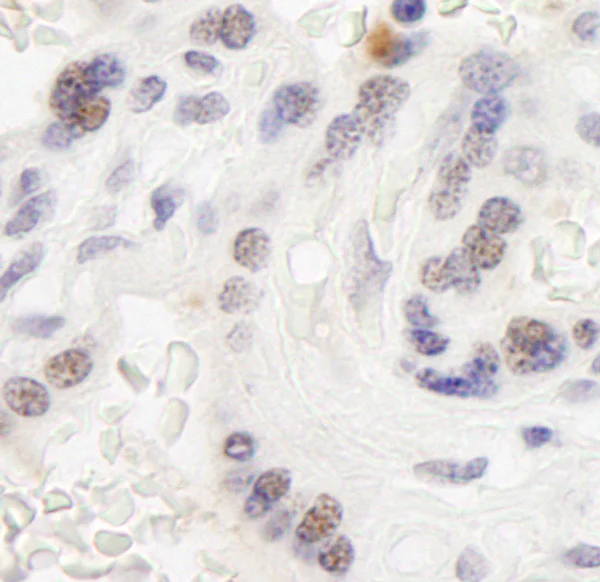 Immunohistochemistry (Formalin/PFA-fixed paraffin-embedded sections) - Anti-WSTF antibody (AB70263)
