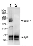 Immunoprecipitation - Anti-WSTF antibody (AB70263)