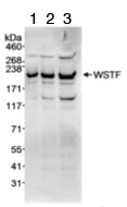 Western blot - Anti-WSTF antibody (AB70263)