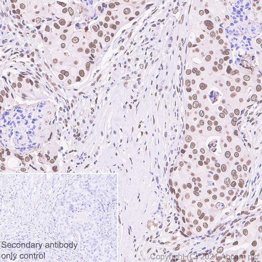 Immunohistochemistry (Formalin/PFA-fixed paraffin-embedded sections) - Anti-WSTF antibody [EP1704Y] (AB51256), expandable thumbnail