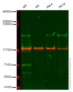 Western blot - Anti-WSTF antibody [EP1704Y] (ab51256), expandable thumbnail
