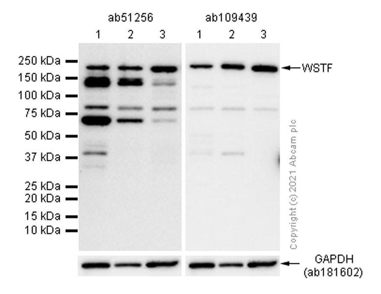 Western blot - Anti-WSTF antibody [EP1704Y] (ab51256), expandable thumbnail