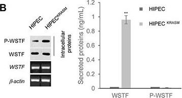Western blot - Anti-WSTF antibody [EP1704Y] (ab51256), expandable thumbnail