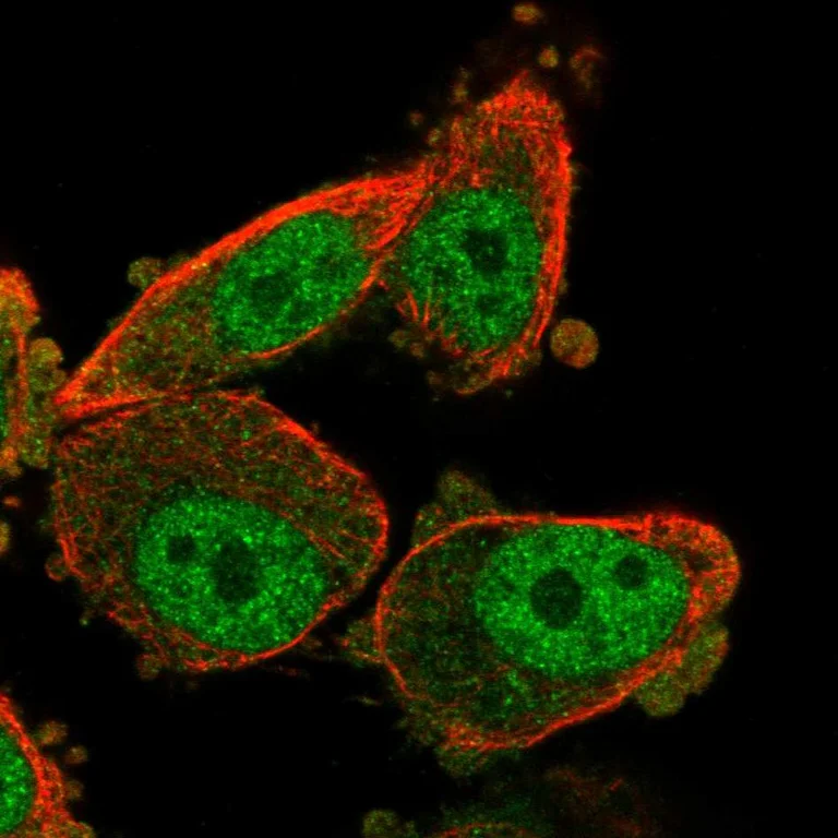 Immunocytochemistry/ Immunofluorescence - Anti-WT1 Antibody (AB327238)
