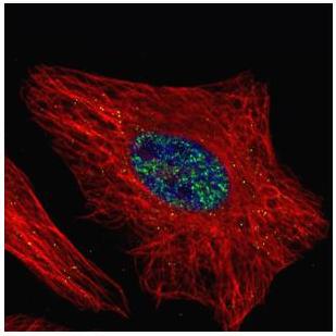 Immunocytochemistry/ Immunofluorescence - Anti-WTAP antibody (AB155655), expandable thumbnail