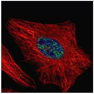 Immunocytochemistry/ Immunofluorescence - Anti-WTAP antibody (AB155655)