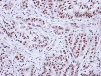 Immunohistochemistry (Formalin/PFA-fixed paraffin-embedded sections) - Anti-WTAP antibody (AB155655), expandable thumbnail