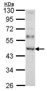 Western blot - Anti-WTAP antibody (AB155655), expandable thumbnail