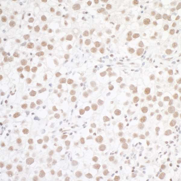 Immunohistochemistry (Formalin/PFA-fixed paraffin-embedded sections) - Anti-WTAP antibody (AB245628), expandable thumbnail