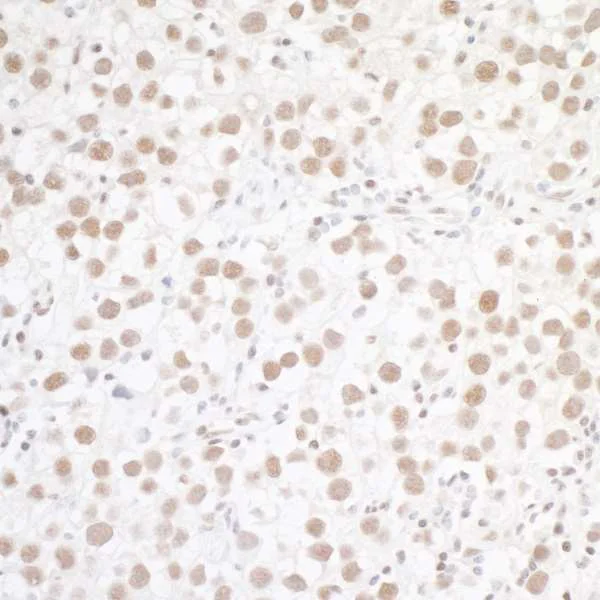 Immunohistochemistry (Formalin/PFA-fixed paraffin-embedded sections) - Anti-WTAP antibody (AB245628)