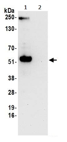 Immunoprecipitation - Anti-WTAP antibody (AB245628), expandable thumbnail