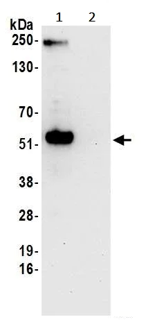 Immunoprecipitation - Anti-WTAP antibody (AB245628)